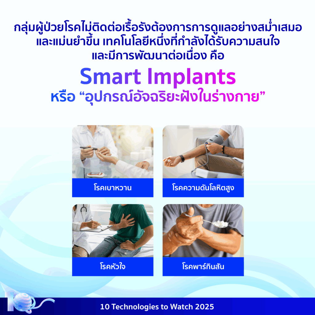 10 Technologies to Watch 2025: อุปกรณ์อัจฉริยะฝังในร่างกาย (Smart Implants)