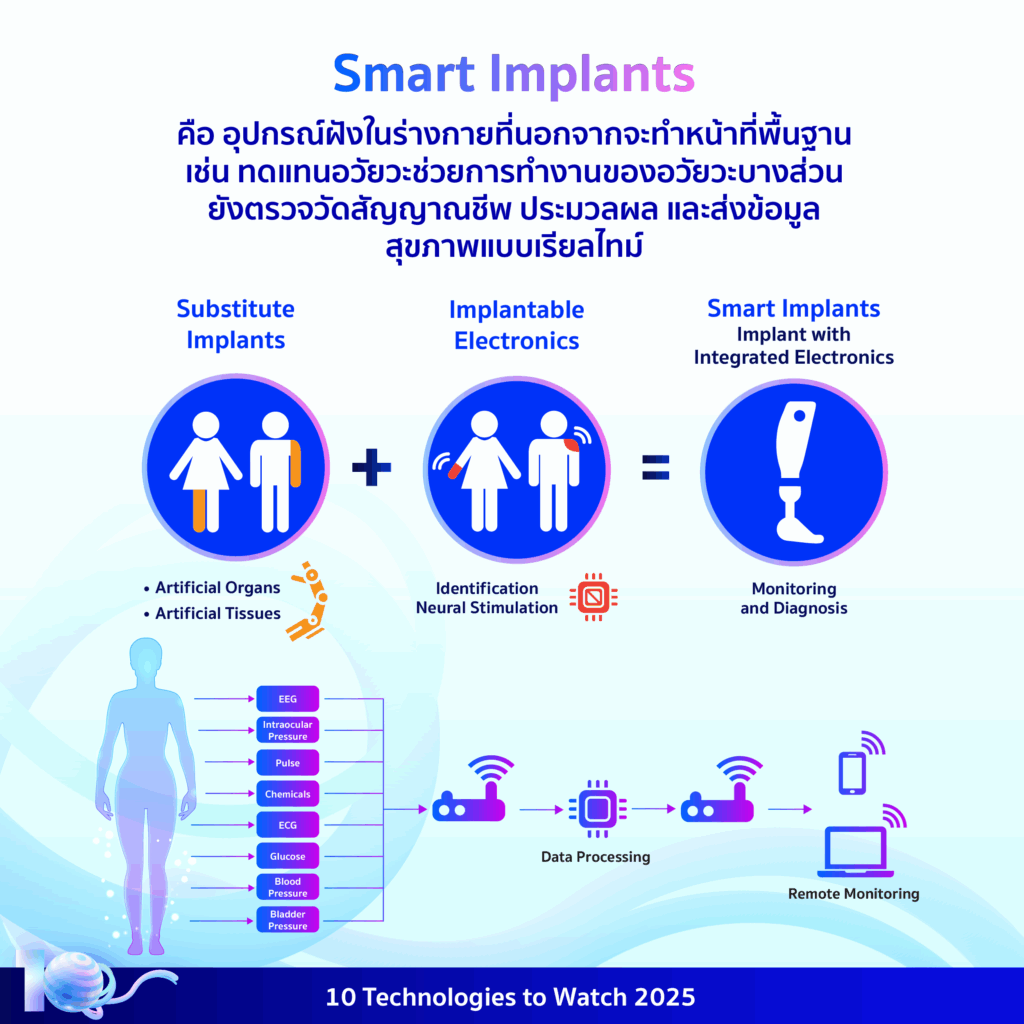 10 Technologies to Watch 2025: อุปกรณ์อัจฉริยะฝังในร่างกาย (Smart Implants)