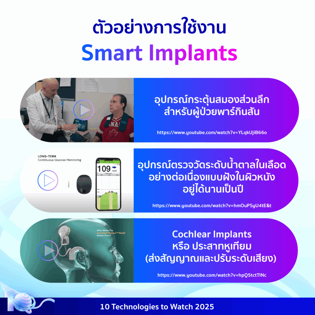 10 Technologies to Watch 2025: อุปกรณ์อัจฉริยะฝังในร่างกาย (Smart Implants)