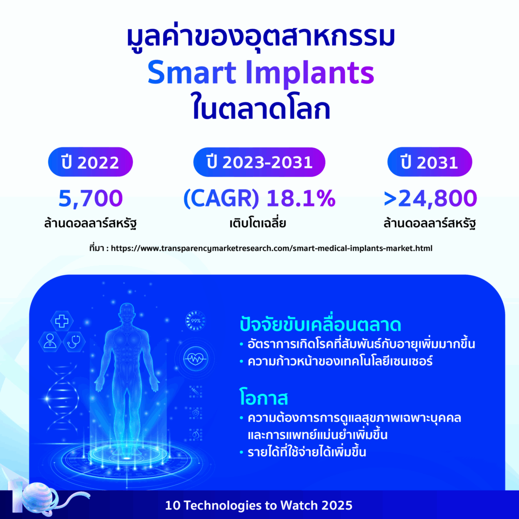 10 Technologies to Watch 2025: อุปกรณ์อัจฉริยะฝังในร่างกาย (Smart Implants)