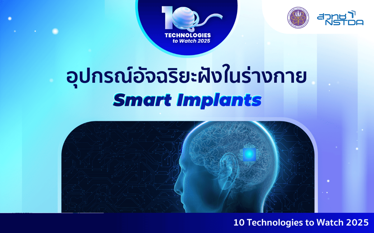 10 Technologies to Watch 2025 อุปกรณ์อัจฉริยะฝังในร่างกาย (Smart Implants)